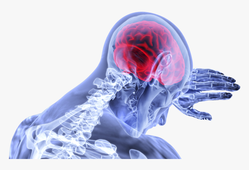 Brain-3168269 - Concussions Png, Transparent Png, Free Download