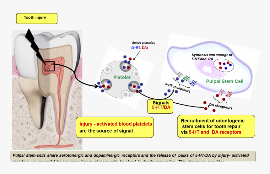 Natural Reparative Capacity Of Teeth Elucidated - Isolation Of Dental Stem Cells, HD Png Download, Free Download