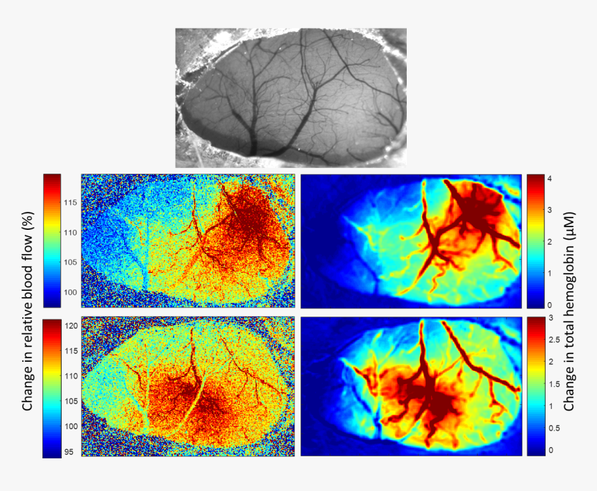 Mslsi I2 - Laser Speckle Imaging Brain, HD Png Download, Free Download