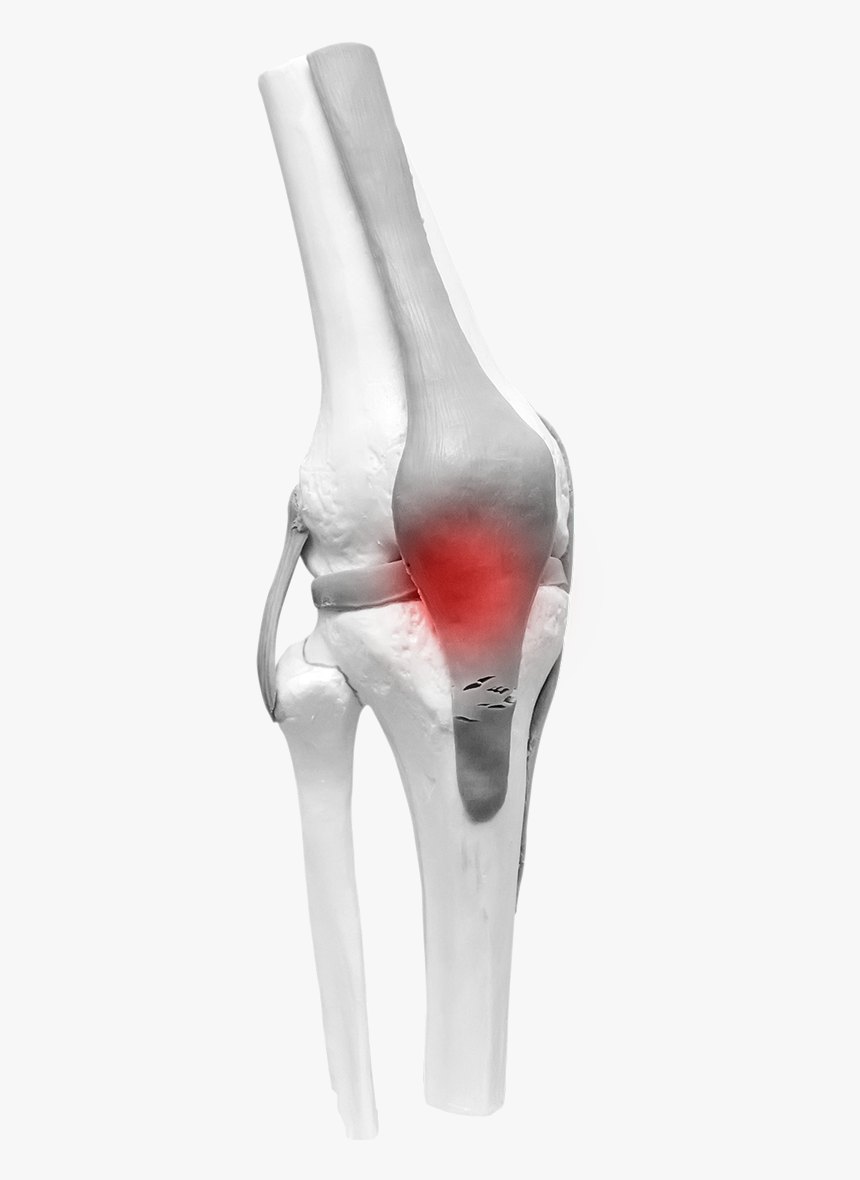 Bone Joint Png, Transparent Png, Free Download