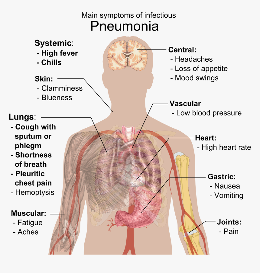 Pneumonia Symptoms, HD Png Download, Free Download