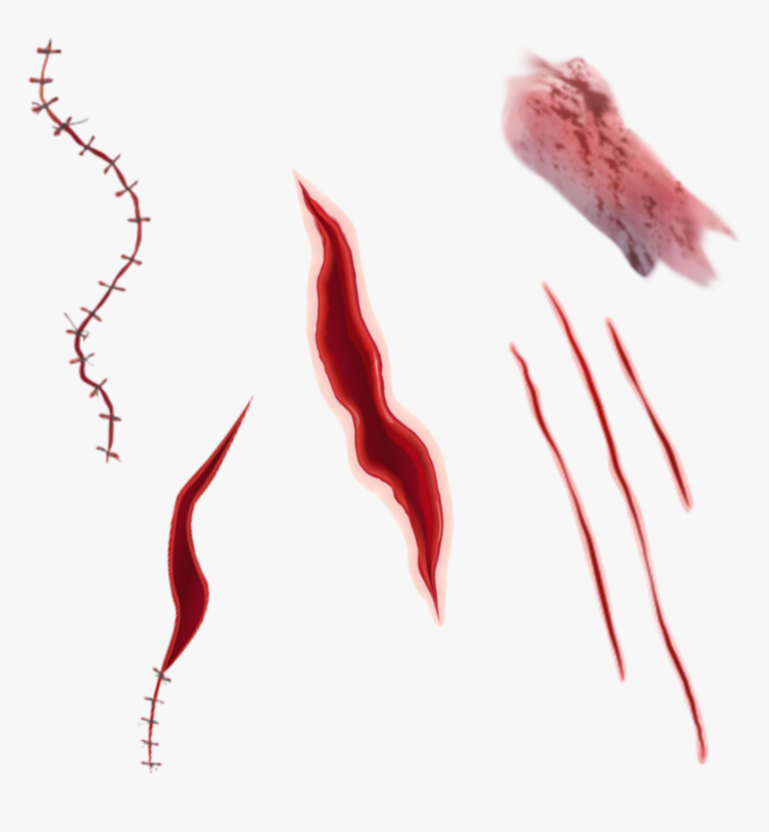 #freetoedit #blood #injury #scar #png - Injury Png, Transparent Png, Free Download