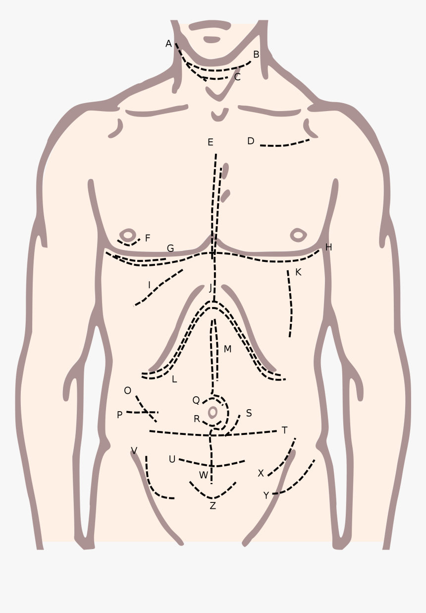 Clip Art Surgical Incision Wikipedia Anatomyedit - Body Chest Clipart, HD Png Download, Free Download