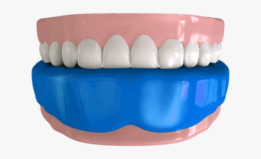 Mouthguard On Lower Teeth Illustration - Smile, HD Png Download, Free Download