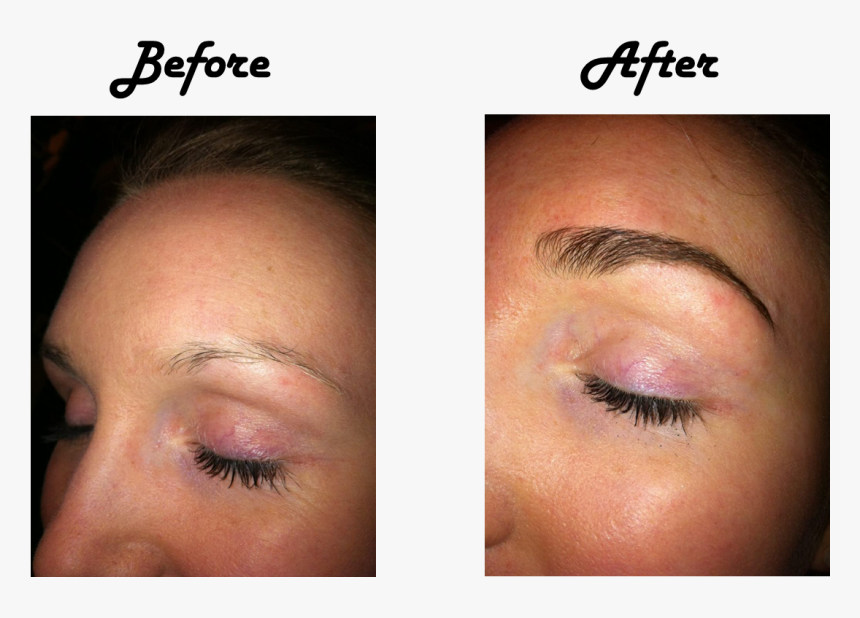 Prp Treatment For Eyebrows , Png Download - Prp Treatment For Eyebrows, Transparent Png, Free Download