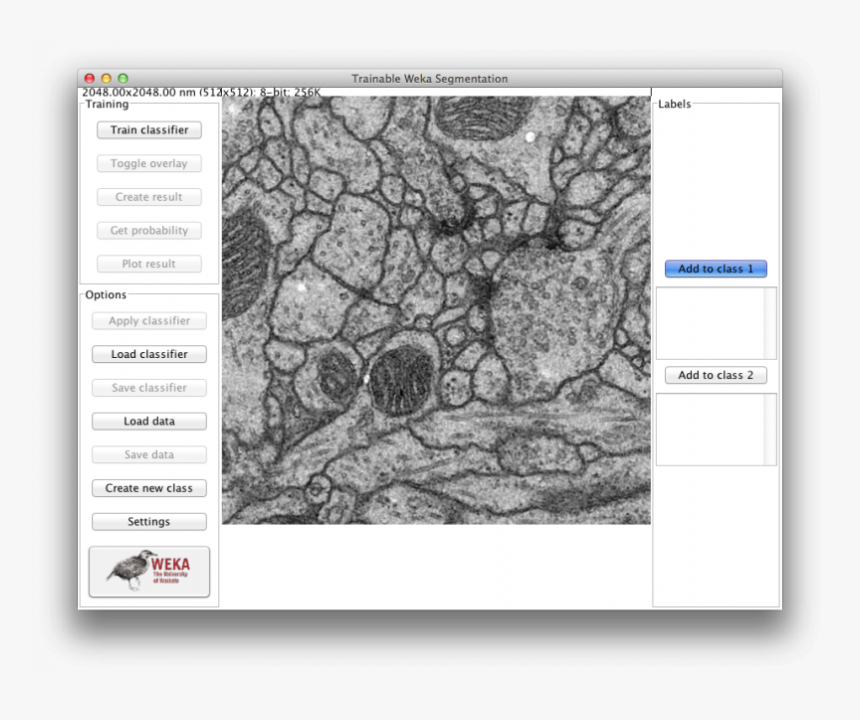 Imagej Trainable Weka Segmentation, HD Png Download, Free Download