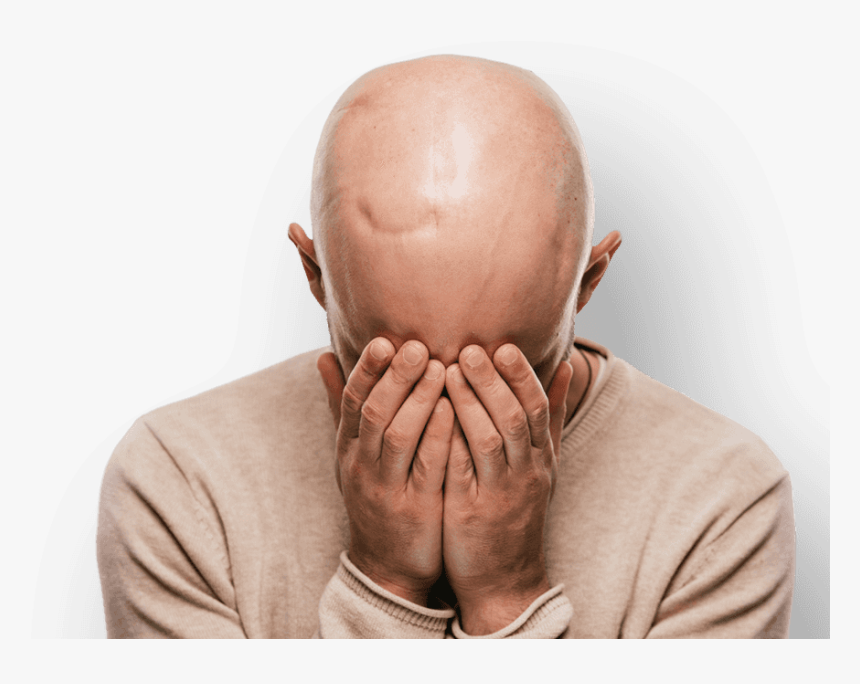 Man With Scarring On Head Holding Hands To Face - Bald Man Crying, HD Png Download, Free Download