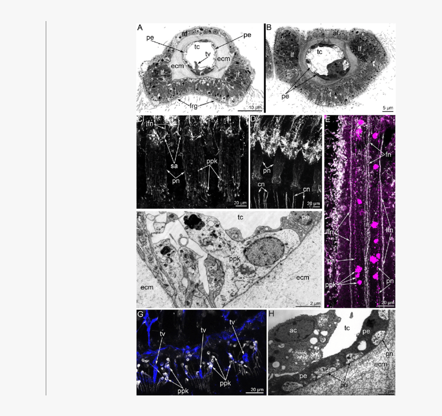 Organization Of Tentacles In Hemithiris Psittacea - Collage, HD Png Download, Free Download