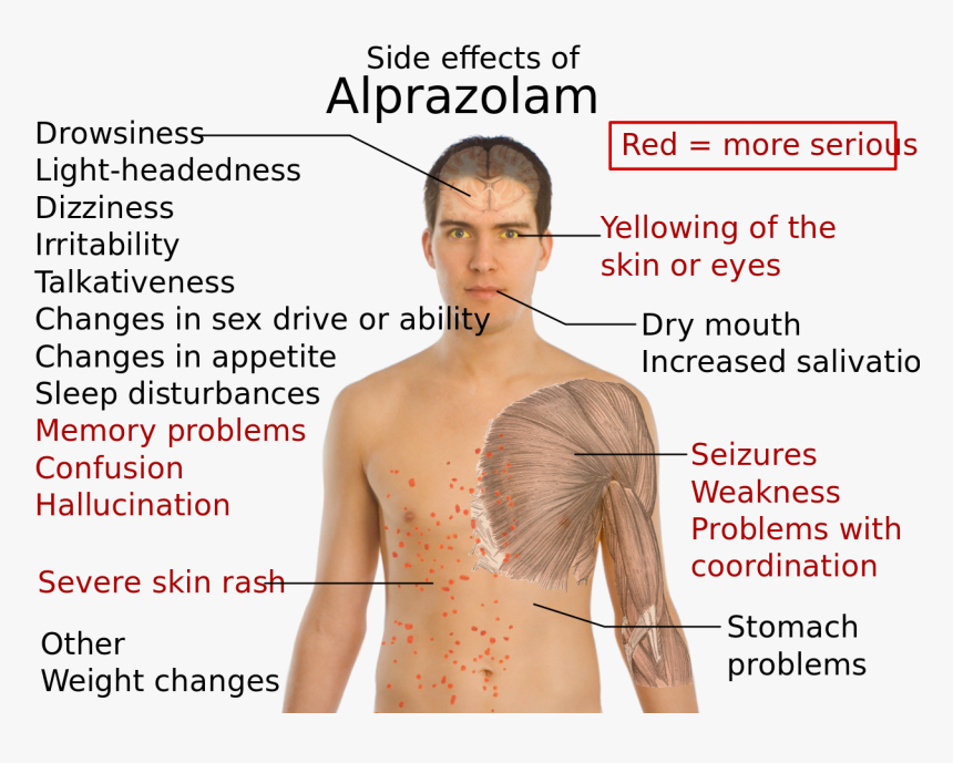 Side Effects Of Alprazolam, HD Png Download, Free Download