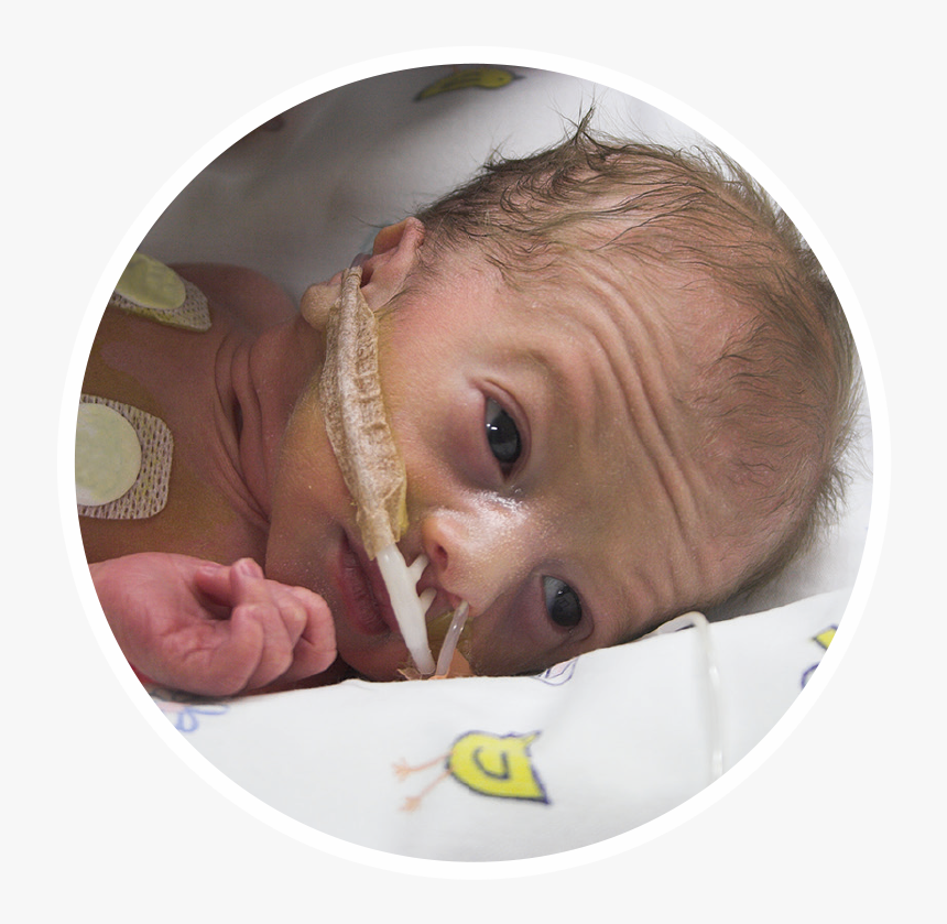 Premature Baby Boy, HD Png Download, Free Download