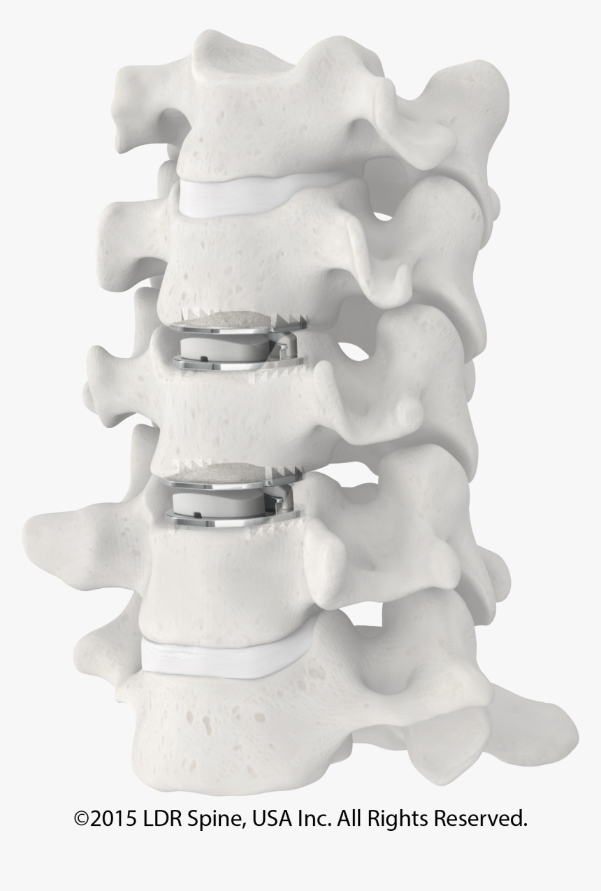 2 Discs In Spine Model - Newest Spine, HD Png Download, Free Download