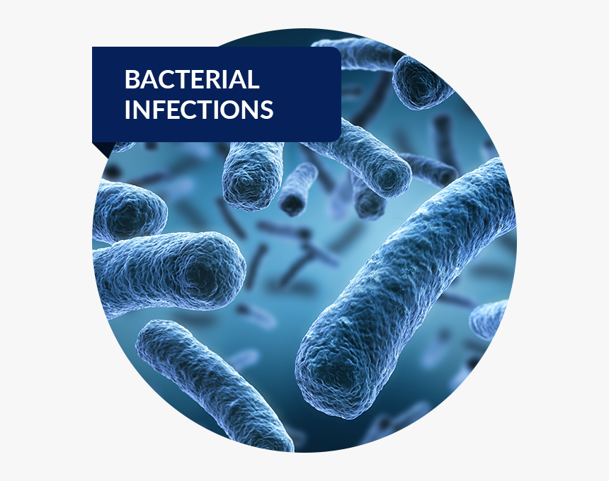 Bacterial Infection, HD Png Download, Free Download