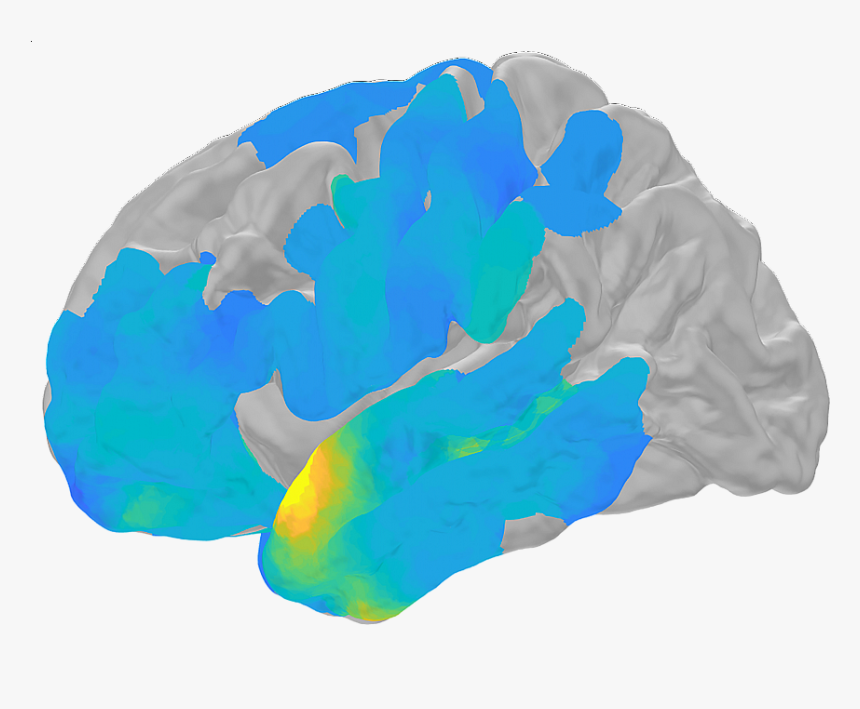 Computer-generated Brain Scan - Neural Oscillation, HD Png Download, Free Download