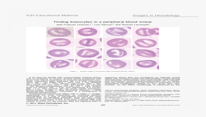 Blood Smear Png, Transparent Png, Free Download