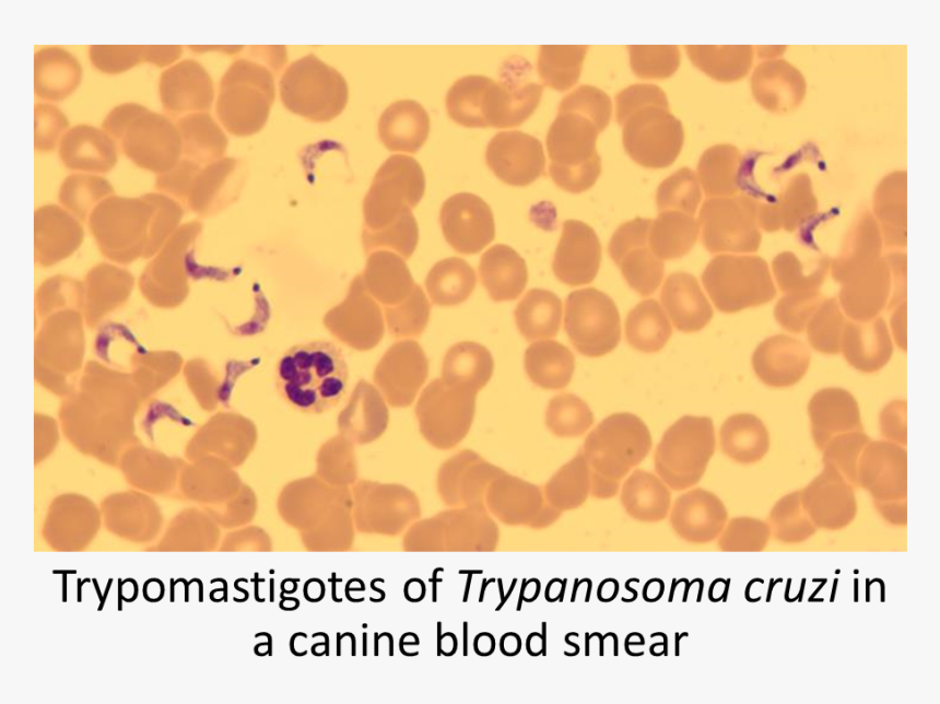 Blood Smear Png, Transparent Png, Free Download