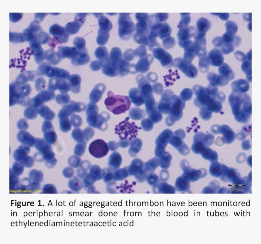 Blood Smear Png, Transparent Png, Free Download