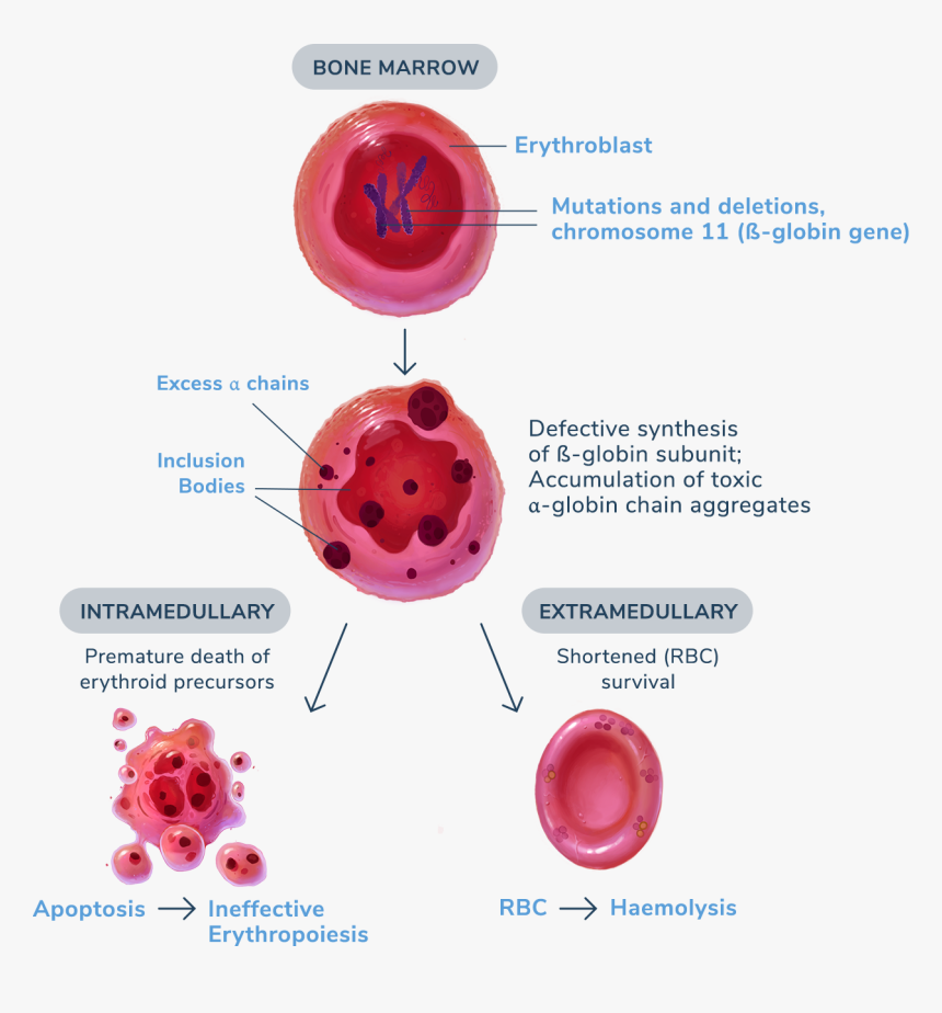 Diagram For Ineffective Erthropoiesis And Haemolysis, HD Png Download, Free Download