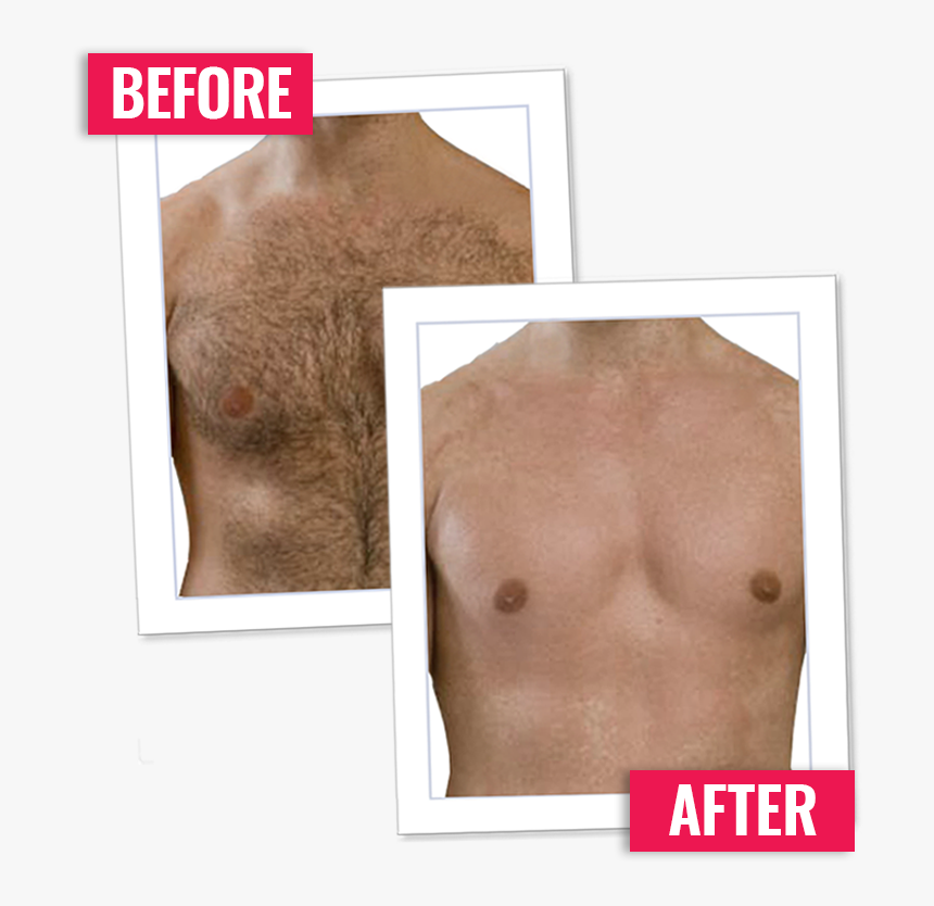 Body Hair Png Hair Removal Men Transparent Png Kindpng