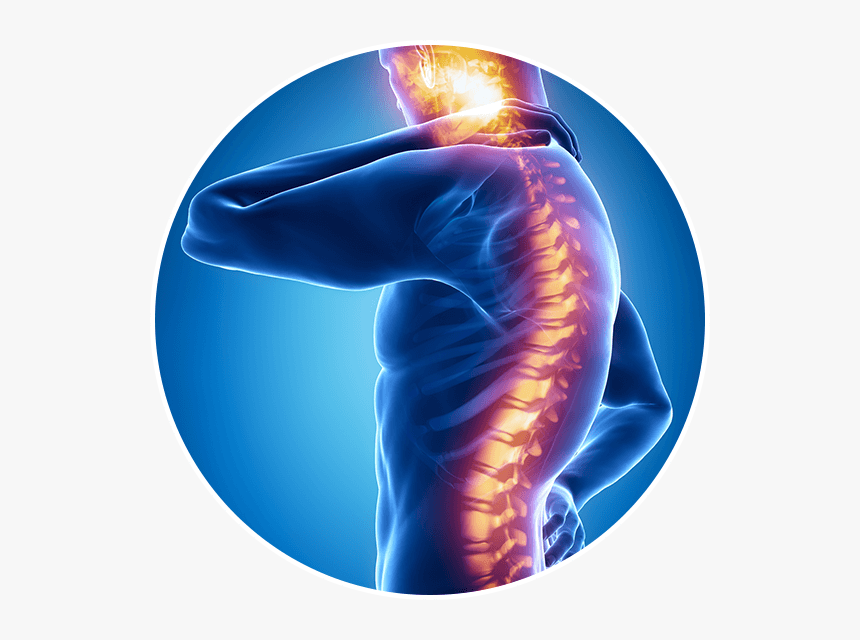 Spine Injury, HD Png Download, Free Download