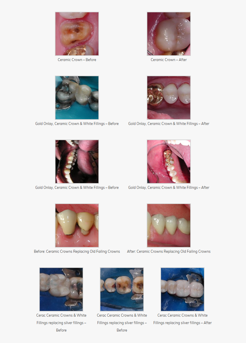 Cosmetic Dentistry, HD Png Download, Free Download
