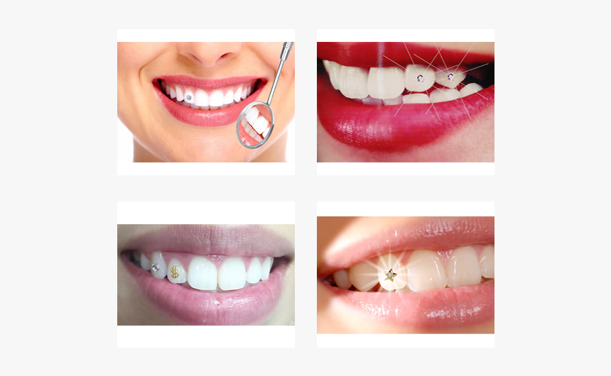 Smiling Faces In Dentistry, HD Png Download, Free Download