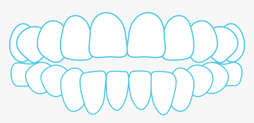 Open Bite - Transparent Clear Aligner Icon, HD Png Download, Free Download