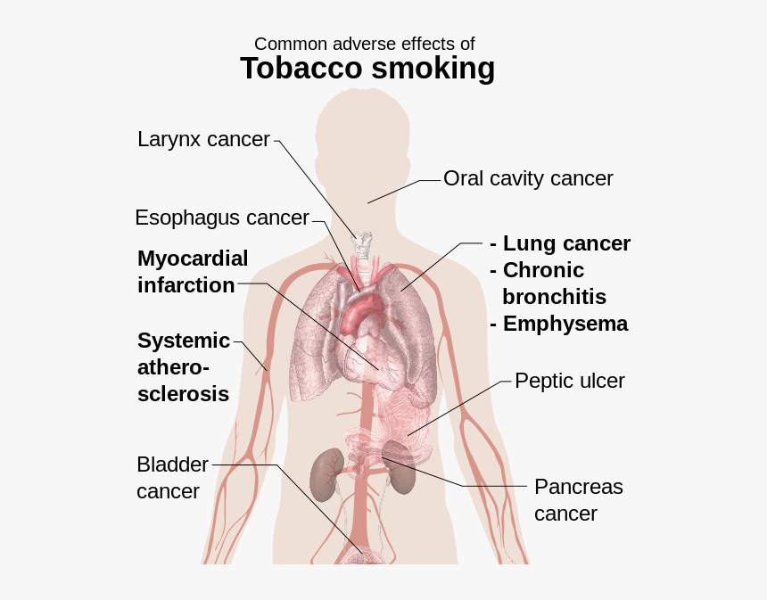 Effects Of Smoking - Effect Of Smoking On Your Body, HD Png Download, Free Download