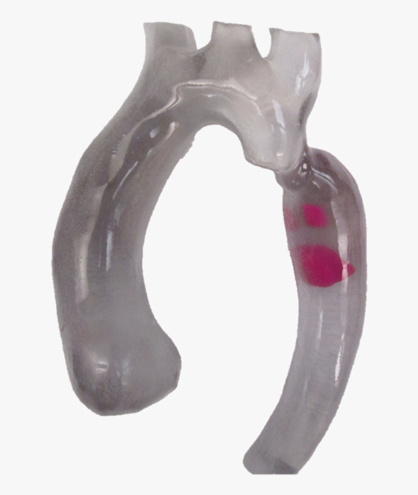 3d Printed Aortic Arch With Thrombus - Diagonal Pliers, HD Png Download, Free Download