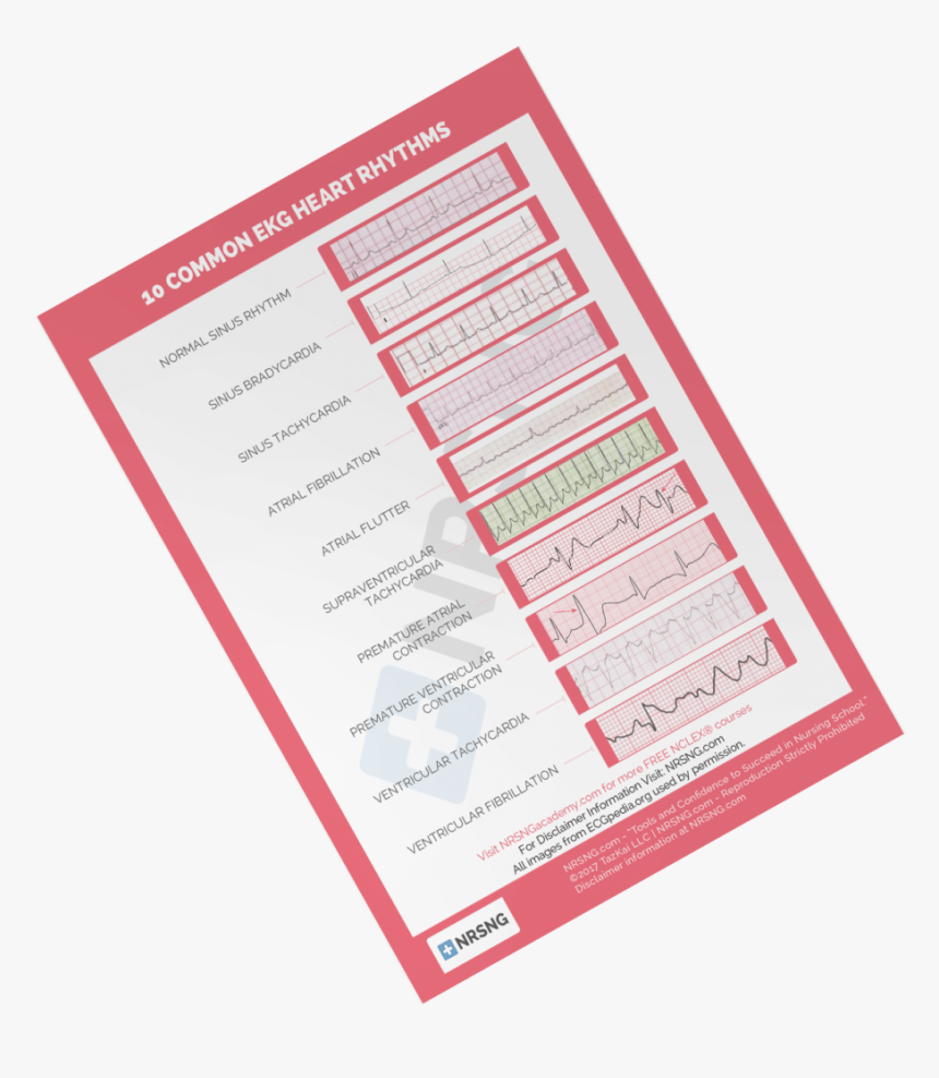 Heart Rhythm Cheatsheet For Nurses - 10 Common Heart Rhythms, HD Png Download, Free Download