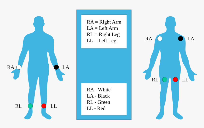 Ecg Ra Rl La Ll, HD Png Download, Free Download