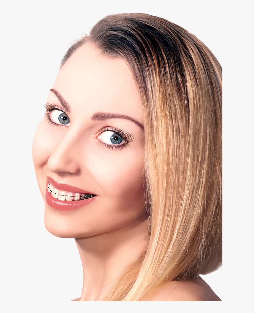 Woman With Damon Braces Looking Over Shoulder - Woman With Braces, HD Png Download, Free Download