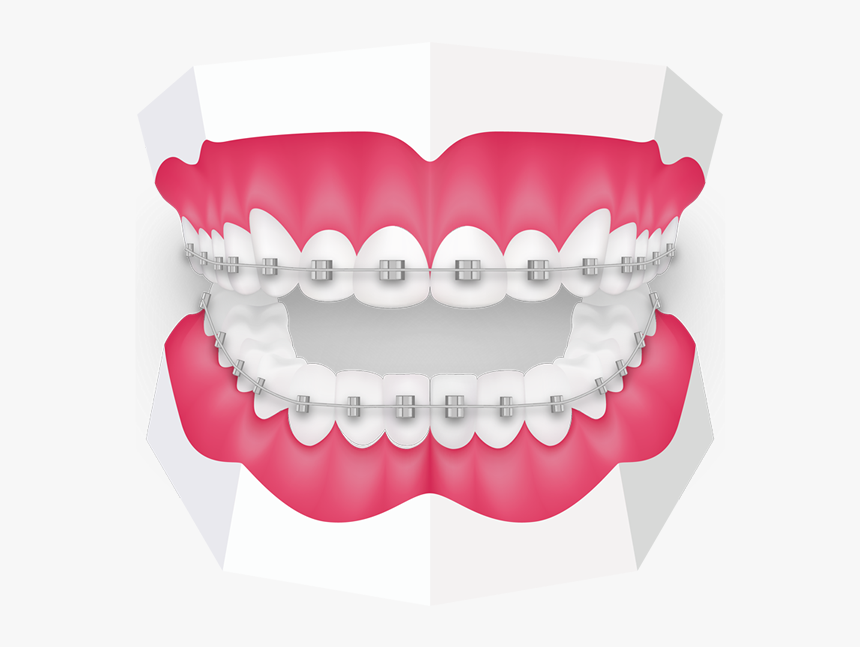 Clipart Orthodontist, HD Png Download, Free Download