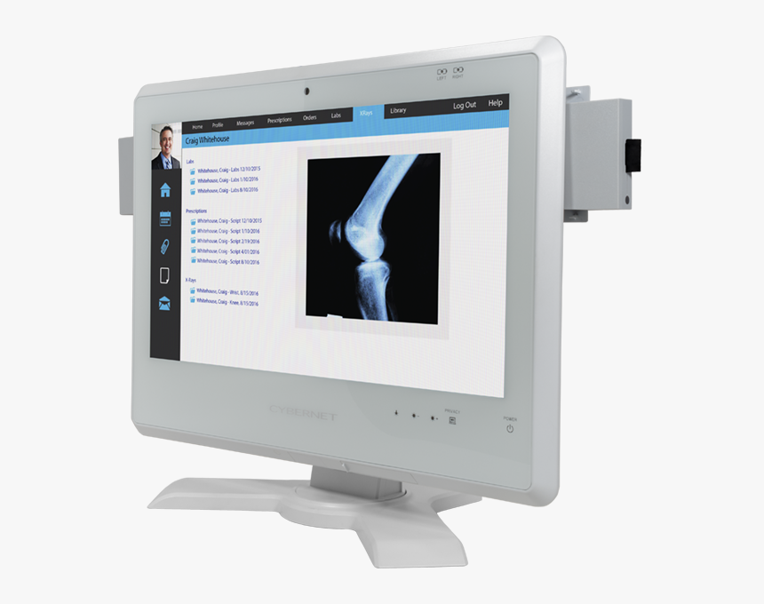 Medical Touch Screen Computer With Battery And Mounting - Computer Monitor, HD Png Download, Free Download