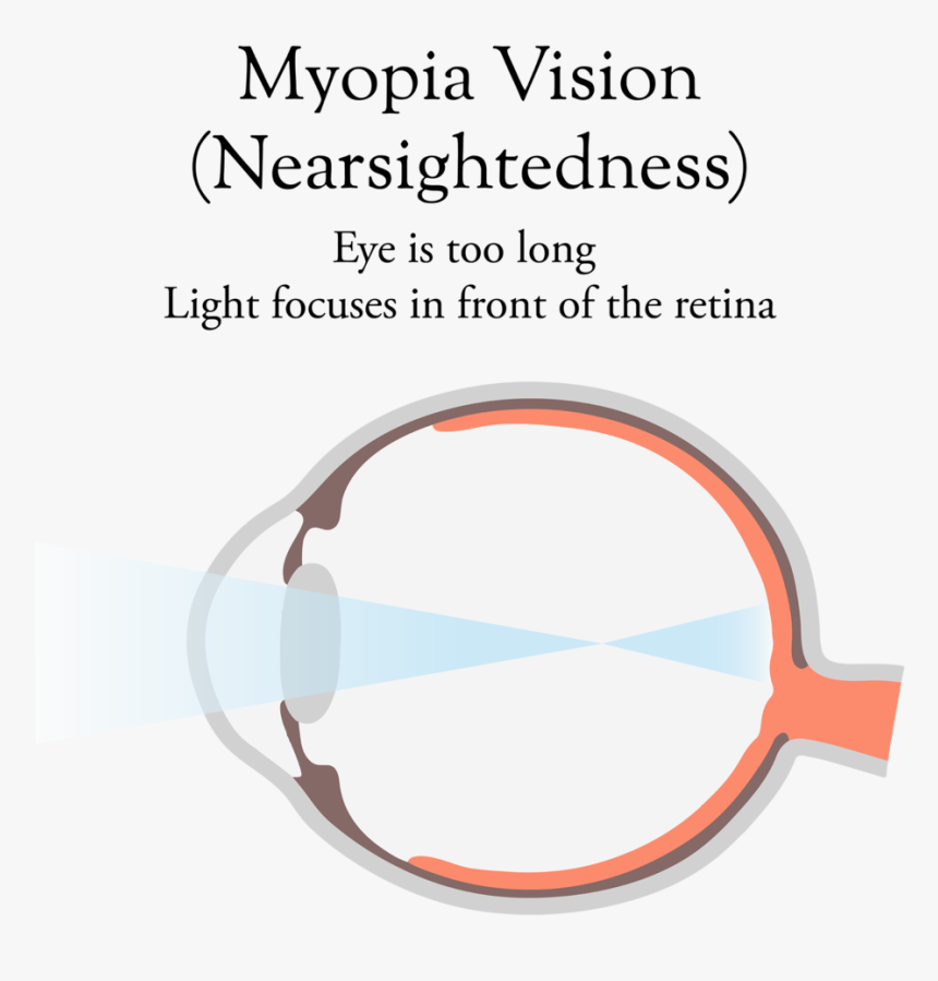 Myopic Eye-02 - Circle, HD Png Download, Free Download