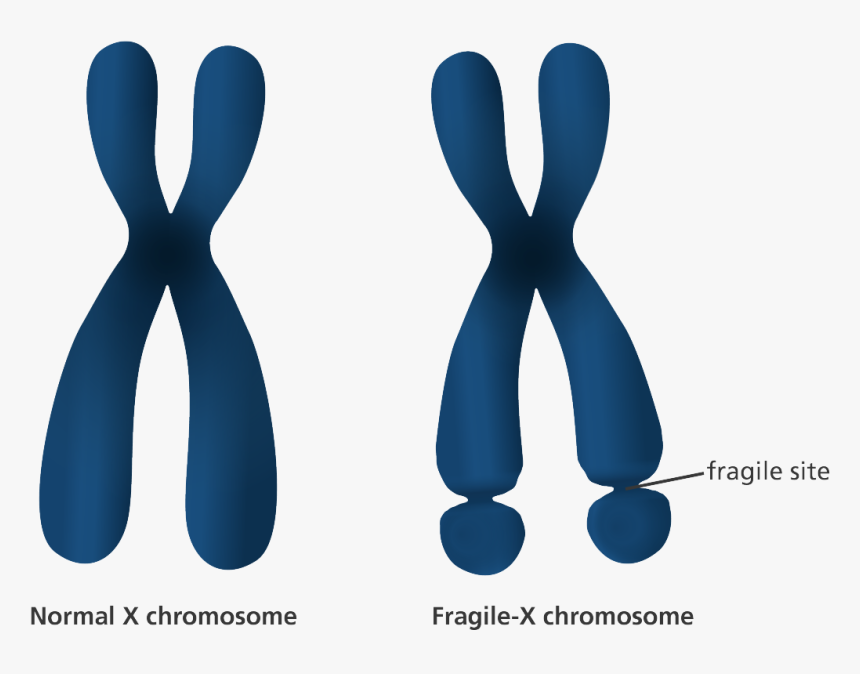 An Illustration Showing The Appearance Of Normal And - Fragile X Syndrome In Women, HD Png Download, Free Download