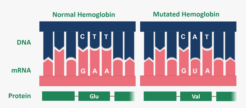 Point Mutation Sickle Cell Normal And Mutated Hemoglobin - Point Mutation Sickle Cell, HD Png Download, Free Download