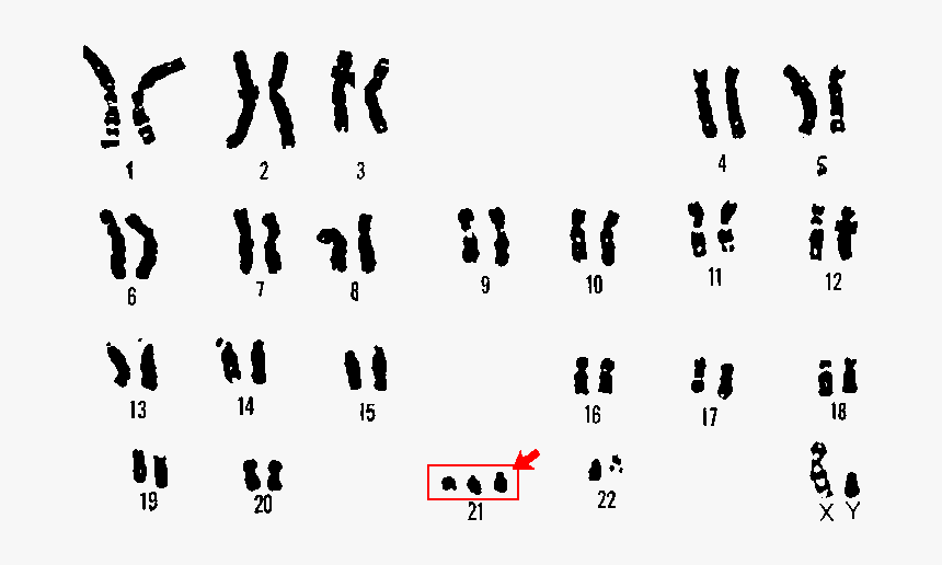 Lou Gehrig's Disease Chromosome, HD Png Download, Free Download