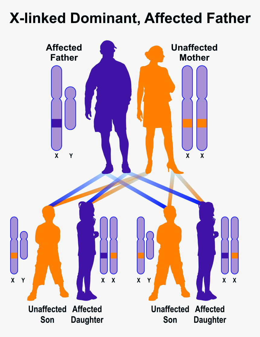 Sanple Pedigree Of X-linked Dominant Inheritance, Father - X Linked Inheritance Dominant, HD Png Download, Free Download