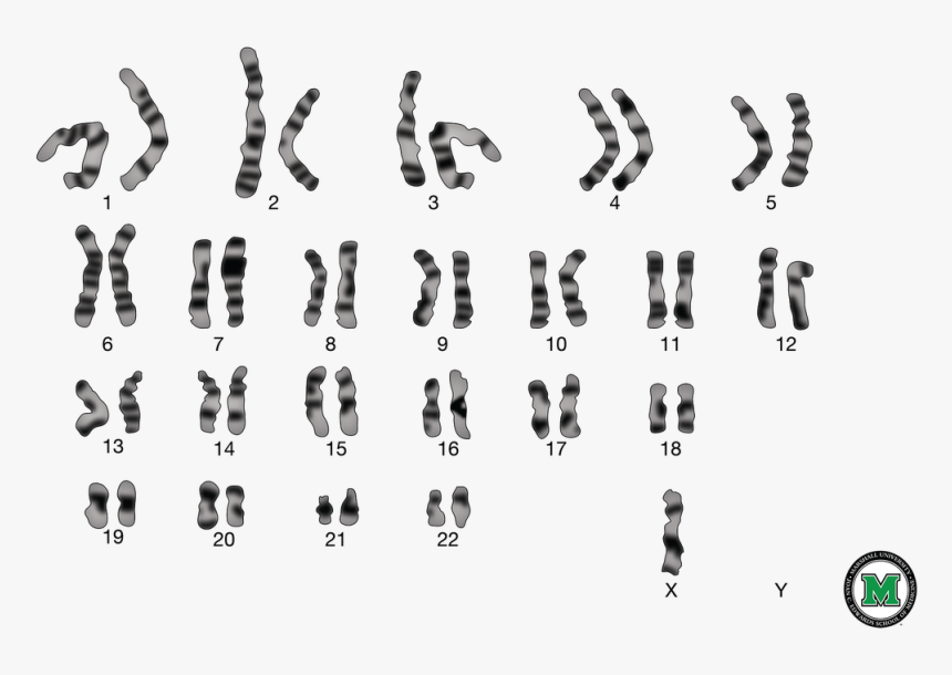 Picture - Hurler Syndrome Chromosome 4, HD Png Download, Free Download