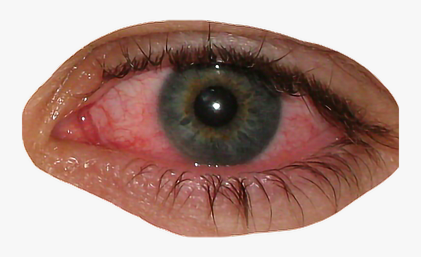 #eye #bloodshot #blood #redeye #bloodshoteyes #face#freetoedit - Red Eye Png, Transparent Png, Free Download