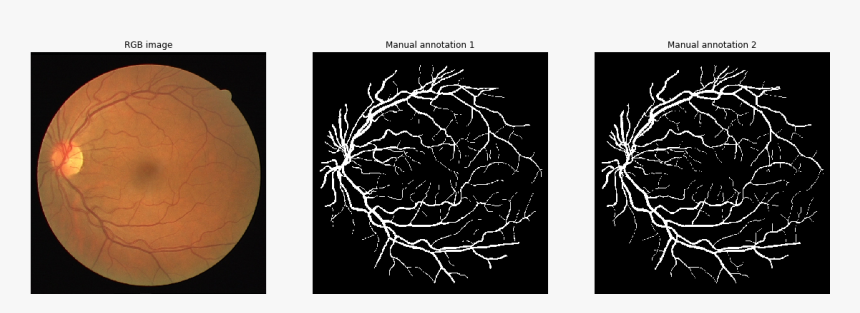 Blood Vessels Image Segmentation, HD Png Download, Free Download