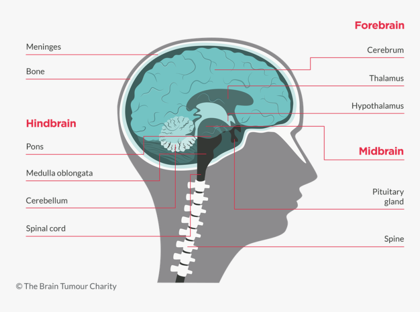 Pontine Tumor, HD Png Download, Free Download