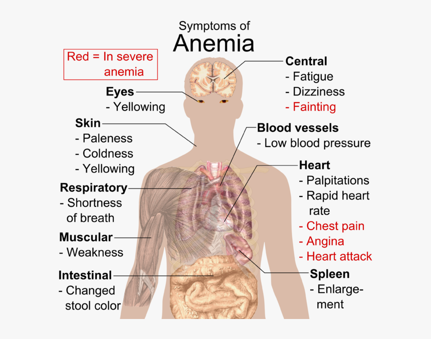 Know If You Re Anemic, HD Png Download, Free Download