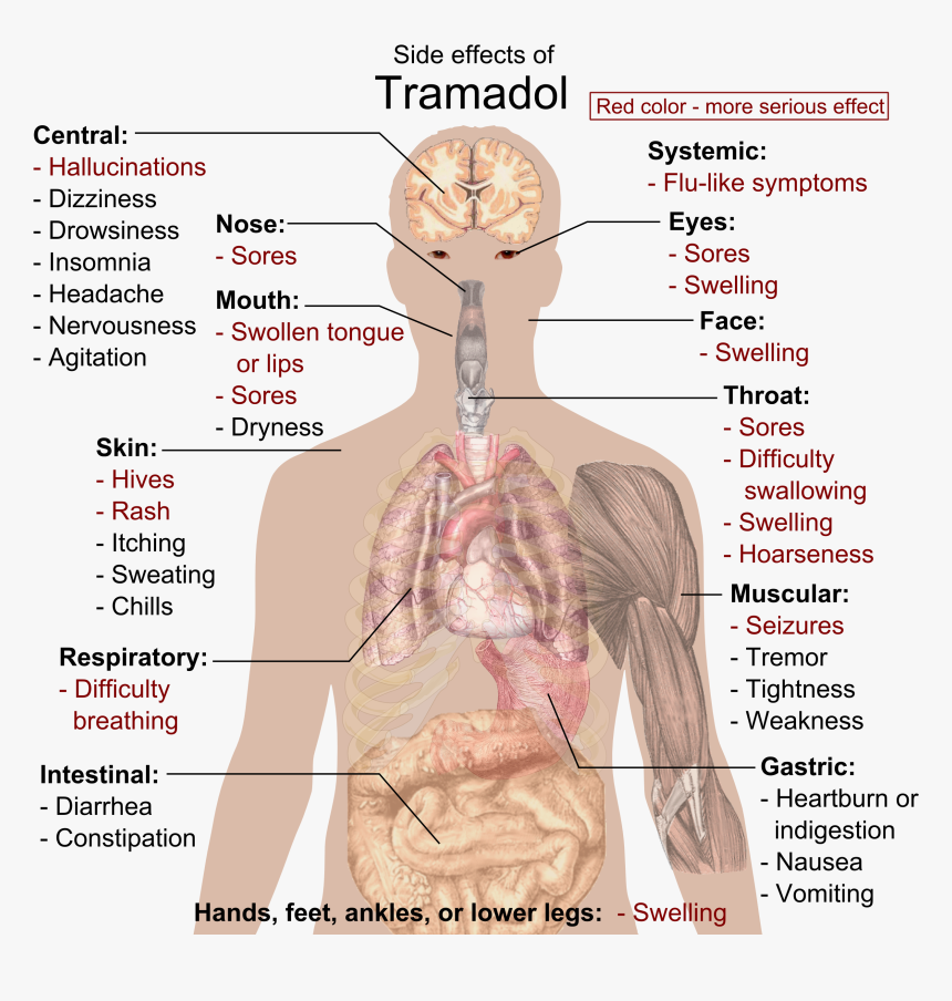 Side Effects Of Tramadol - Human Body Diagram, HD Png Download, Free Download