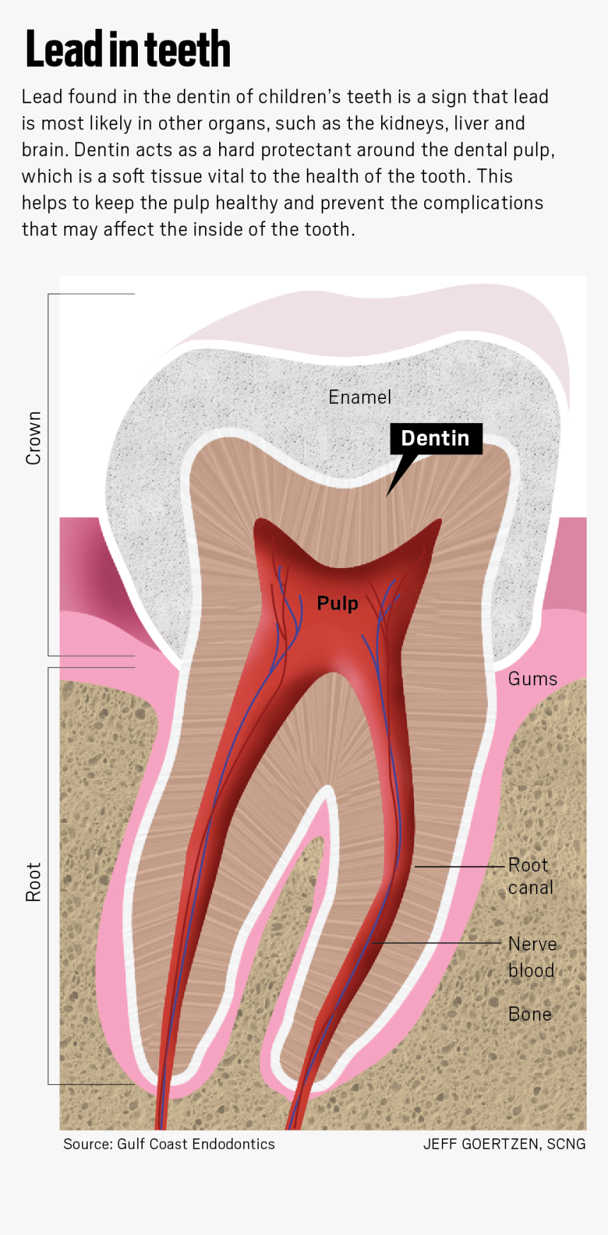 Transparent Monster Teeth Png - Lead Poison On Teeth, Png Download, Free Download