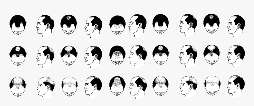 Baldheader1600 - Male Bald Pattern, HD Png Download, Free Download