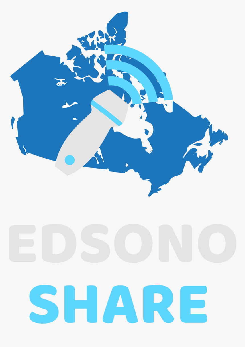 Edsonoshare - Mont Tremblant Quebec Map, HD Png Download, Free Download