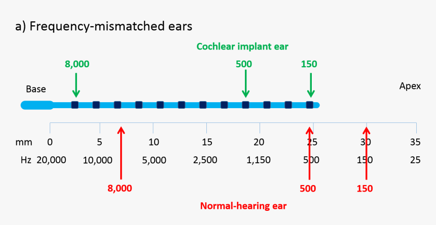 Cochlear Implant Frequency Electrode, HD Png Download, Free Download