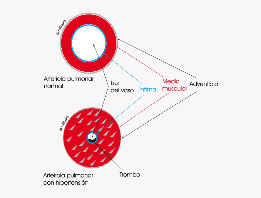Vasoconstricción Pulmonar, HD Png Download, Free Download