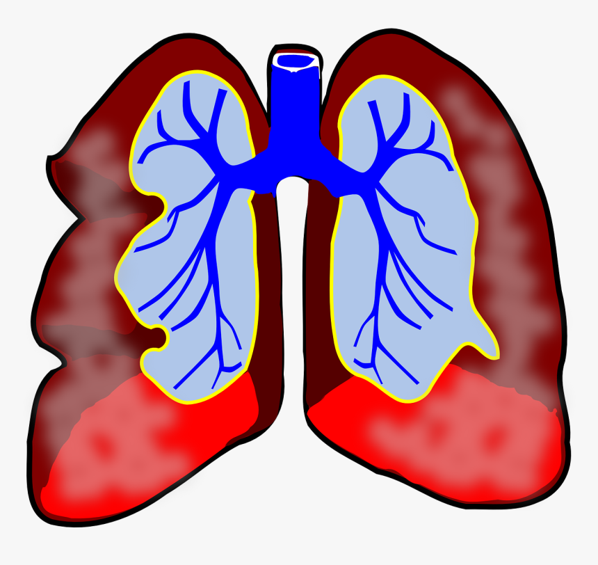 Pulmones, Humana, Diagrama, Respiratorio, La Biología - Lung With Cancer Clipart, HD Png Download, Free Download